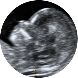 ULTRASONIDO OBSTETRICO