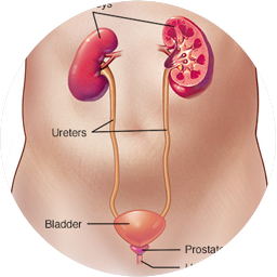 ULTRASONIDO RENAL Y VIAS URINARIAS