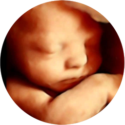 ULTRASONIDO OBSTETRICO 4D